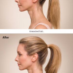 Side profile images of a woman with a ponytail illustrate the hair transformation before and after using Invati advanced scalp revitalizer. The 