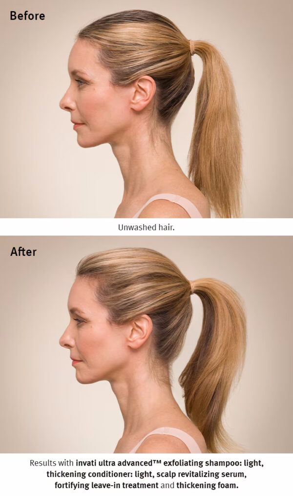 Side profile images of a woman with a ponytail illustrate the hair transformation before and after using Invati advanced scalp revitalizer. The "Before" image shows unwashed hair, whereas the "After" image reveals noticeably thicker-looking hair. - SAAB Salon Spa | Ottawa On, Canada