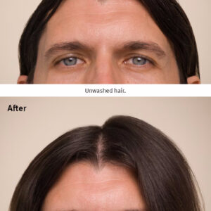 Before and after images of a person's hair. The before image shows unwashed hair, while the after image portrays thicker and healthier-looking hair, thanks to the use of Invati advanced scalp revitalizer. - SAAB Salon Spa | Ottawa On, Canada