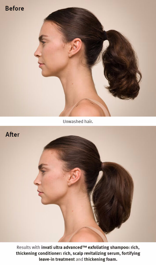 Side profile comparison of a woman with unwashed hair in a ponytail labeled "Before" and the same woman with voluminous hair in a ponytail after using Invati Ultra Advanced Thickening Conditioner - Rich, labeled "After". - SAAB Salon Spa | Ottawa On, Canada