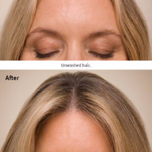 Before and after images of a person's scalp, showing noticeable hair thickening and improved hair density after using Invati Ultra Advanced Thickening Conditioner - Light. The 