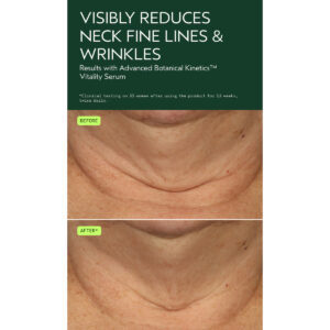 Before-and-after close-ups of a person's neck reveal fewer fine lines and wrinkles after using Advanced Botanical Kinetics Vitality Serum, highlighting the serum’s visible, age-defying benefits. - SAAB Salon Spa | Ottawa On, Canada
